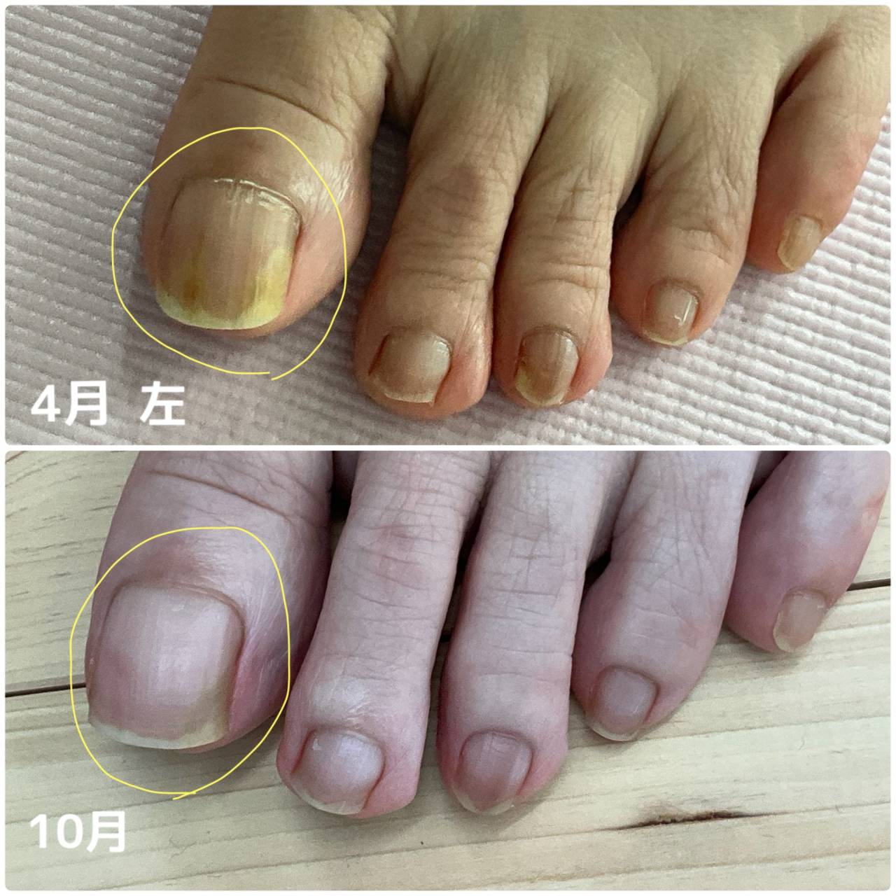 セルフケアで爪が健康にきれいに!