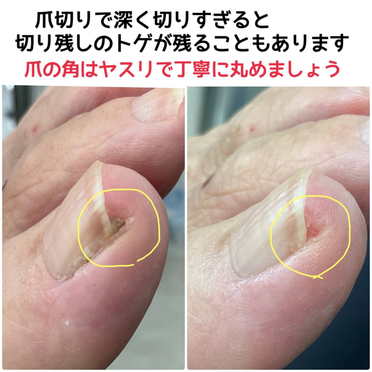 爪の角は切りすぎないように注意しましょう